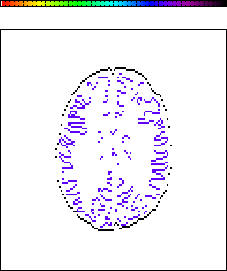 \resizebox*{5cm}{6cm}{\includegraphics{imgps/f_hof_discx.ps}}